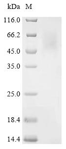 Recombinant Ustilaginoidea virens Phosphoacetylglucosamine mutase