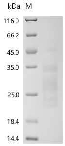 Recombinant Human Mannose-binding protein C (MBL2)