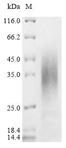 Recombinant Streptococcus agalactiae serotype III Single-stranded DNA-binding protein 1 (ssb1)