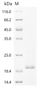 Recombinant Human Cytochrome c oxidase subunit 1 (MT-CO1), partial
