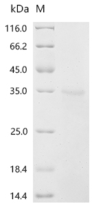 Recombinant Human Deoxyribonuclease-1 (DNASE1)