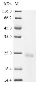 Recombinant Tobacco mosaic virus Capsid protein (CP)