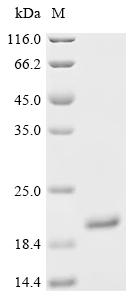 Recombinant Human Lipocalin-1 (LCN1)