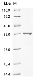 Recombinant Escherichia coli Large ribosomal subunit protein bL25 (rplY)