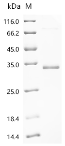 Recombinant Macaca fascicularis Lymphotoxin beta receptor (LTBR), partial