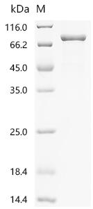 Recombinant Human Multiple inositol polyphosphate phosphatase 1 (MINPP1)