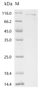Recombinant Human TRMT1-like protein (TRMT1L)
