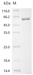 Recombinant Human Sushi repeat-containing protein SRPX2 (SRPX2)