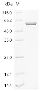 Recombinant Mouse Histone deacetylase 2 (Hdac2)