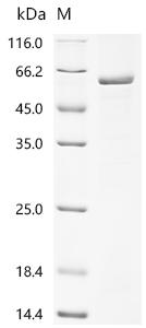 Recombinant Human Inactive hydroxysteroid dehydrogenase-like protein 1 (HSDL1)