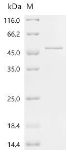 Recombinant Spinacia oleracea Phosphoribulokinase, chloroplastic