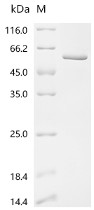 Recombinant Mouse Neurogenic differentiation factor 1 (Neurod1)(H115A)