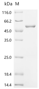 Recombinant Human Casein kinase II subunit alpha (CSNK2A1)