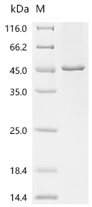Recombinant Human Leucine-rich repeat-containing protein 28 (LRRC28)