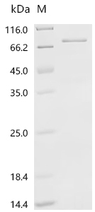 Recombinant Human Polyunsaturated fatty acid 5-lipoxygenase (ALOX5)