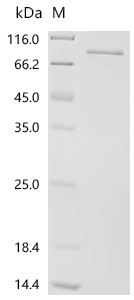 Recombinant Human Polyunsaturated fatty acid 5-lipoxygenase (ALOX5)