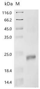 Recombinant Mouse Inhibin beta E chain (Inhbe)