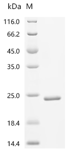 Recombinant Human Bromodomain-containing protein 2 (BRD2), partial