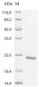 Recombinant Human Bromodomain-containing protein 4 (BRD4), partial