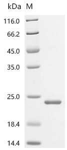 Recombinant Human Bromodomain-containing protein 4 (BRD4), partial