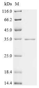 Recombinant Mouse Hemoglobin subunit alpha (Hba)