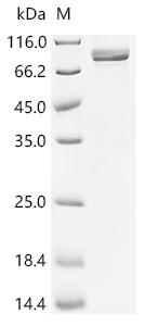 Recombinant Human Bifunctional UDP-N-acetylglucosamine 2-epimerase/N-acetylmannosamine kinase (GNE)