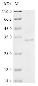 Recombinant Human Protein phosphatase PTC7 homolog (PPTC7)