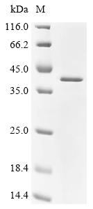Recombinant Human Ribonuclease H1 (RNASEH1)