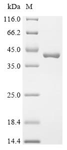 Recombinant Shigella flexneri Virulence sensor protein PhoQ (phoQ), partial