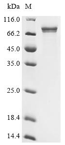 Recombinant Human Lysine-specific demethylase RSBN1L (RSBN1L), partial