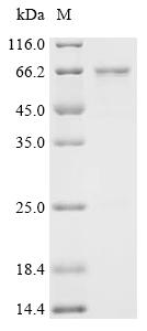 Recombinant Human Probable RNA-binding protein 46 (RBM46)