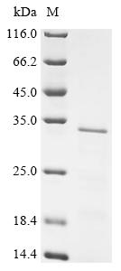 Recombinant Human Protein L-Myc (MYCL), partial