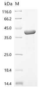 Recombinant Epstein-Barr virus Envelope glycoprotein L (gL)