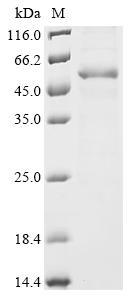Recombinant Human Androgen receptor (AR) , partial