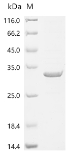 Recombinant Human PRELI domain-containing protein 1, mitochondrial (PRELID1)