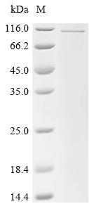 Recombinant Human Fibulin-1 (FBLN1)