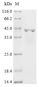Recombinant Pig Aldo-keto reductase family 1 member A1 (AKR1A1)