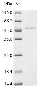 Recombinant Human Poly [ADP-ribose] polymerase tankyrase-2 (TNKS2), partial