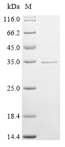 Recombinant Human Protein GAPT (GAPT), partial