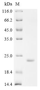 Recombinant Human Lysozyme C (LYZ)