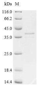 Recombinant Human STEAP1 protein (STEAP1), partial