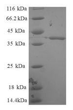 Recombinant Human Enhancer of rudimentary homolog (ERH)