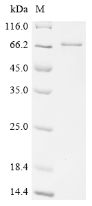 Recombinant Human Paired box protein Pax-7 (PAX7)