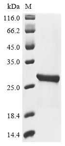 Recombinant Carnation Italian ringspot virus RNA silencing suppressor p19 (ORF4)