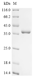 Recombinant Human U1 small nuclear ribonucleoprotein A (SNRPA), partial