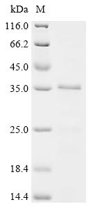 Recombinant Human SUN domain-containing protein 1 (SUN1), partial