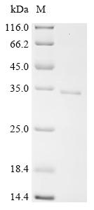 Recombinant Human Regulator of G-protein signaling 16 (RGS16)