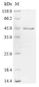Recombinant Human Chromodomain-helicase-DNA-binding protein 4 (CHD4), partial