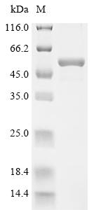 Recombinant Human D-3-phosphoglycerate dehydrogenase (PHGDH), partial