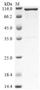 Recombinant Human BPI fold-containing family A member 3 (BPIFA3)